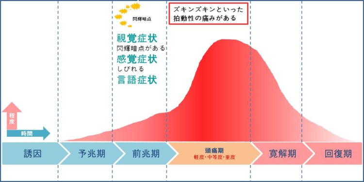 片頭痛とは 症状 原因 治療 病院の診療科目 病気スコープ