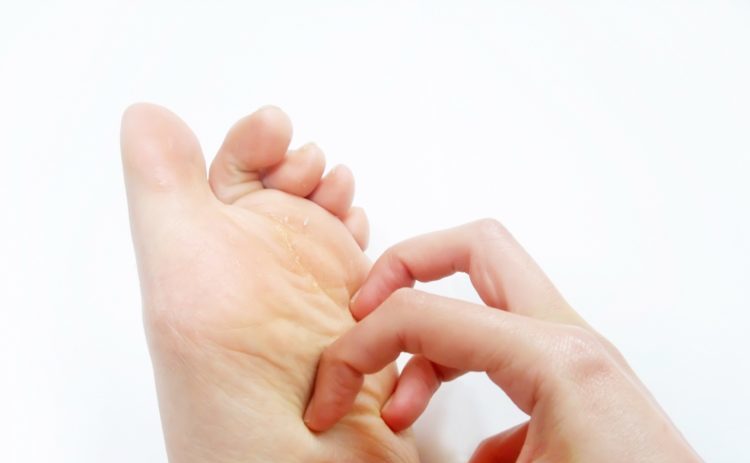 足の裏がかゆい ストレスや肝臓の病気が原因かも 指の間の皮むけは水虫 皮膚の乾燥や汗の対処法を紹介 病気スコープ