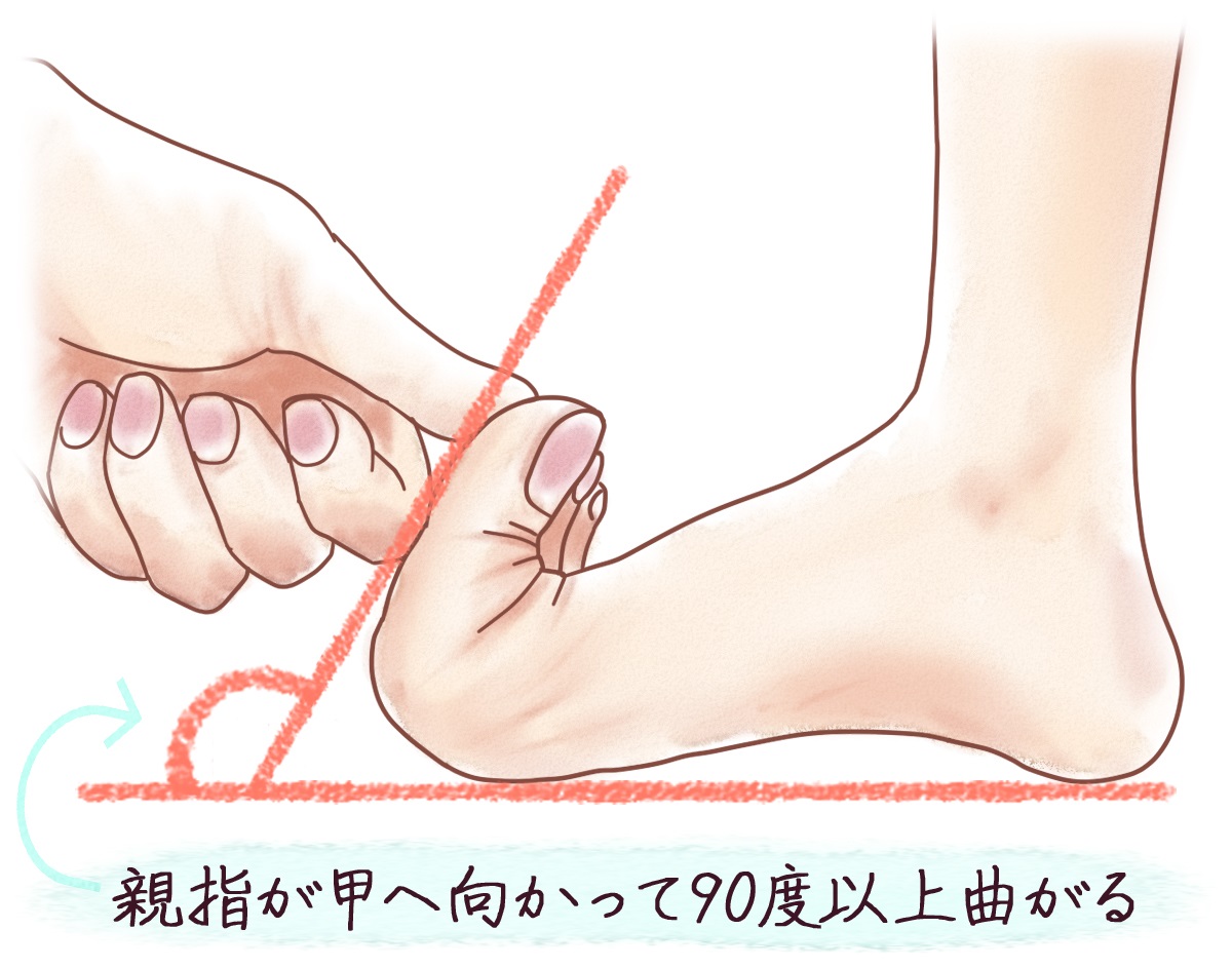 自分でできる浮き指の改善方法５つ 放置すると腰痛や肩こりの原因に 病気スコープ